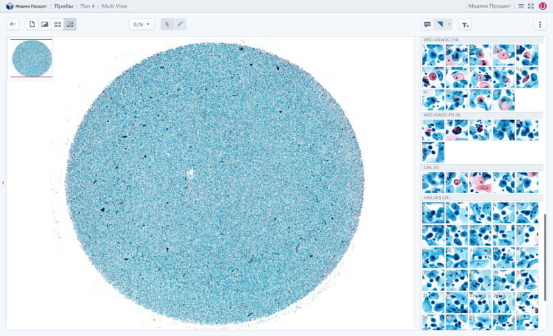 Скриншот Vision Suite картинка 2